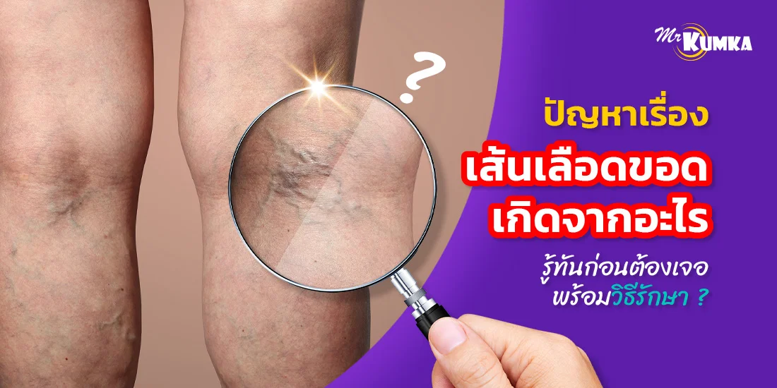 เปรียบเทียบประกันมะเร็งกับ MrKumka.com